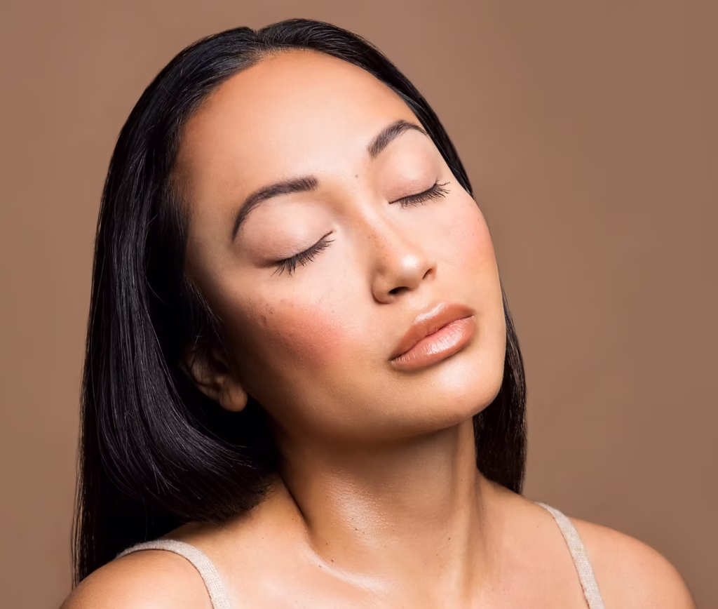Picture of womans face after receiving dermal filler