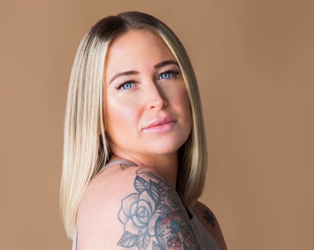 The Wonders of PRP for Skin and Undereye Rejuvenation